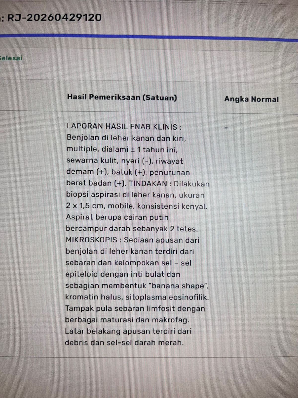 Tidak Ada Photo
